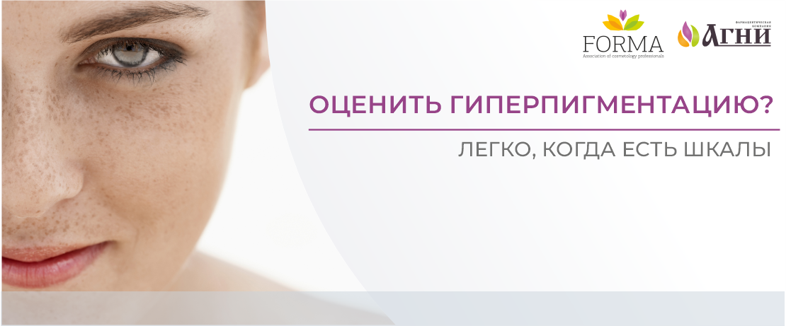 Оценить гиперпигментацию? Легко, когда есть шкалы