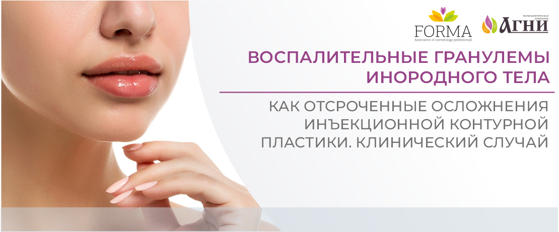 Воспалительные гранулемы инородного тела как отсроченные осложнения инъекционной контурной пластики. Клинический случай