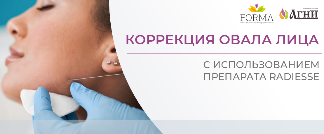 Коррекция овала лица с Radiesse® (Радиес®)