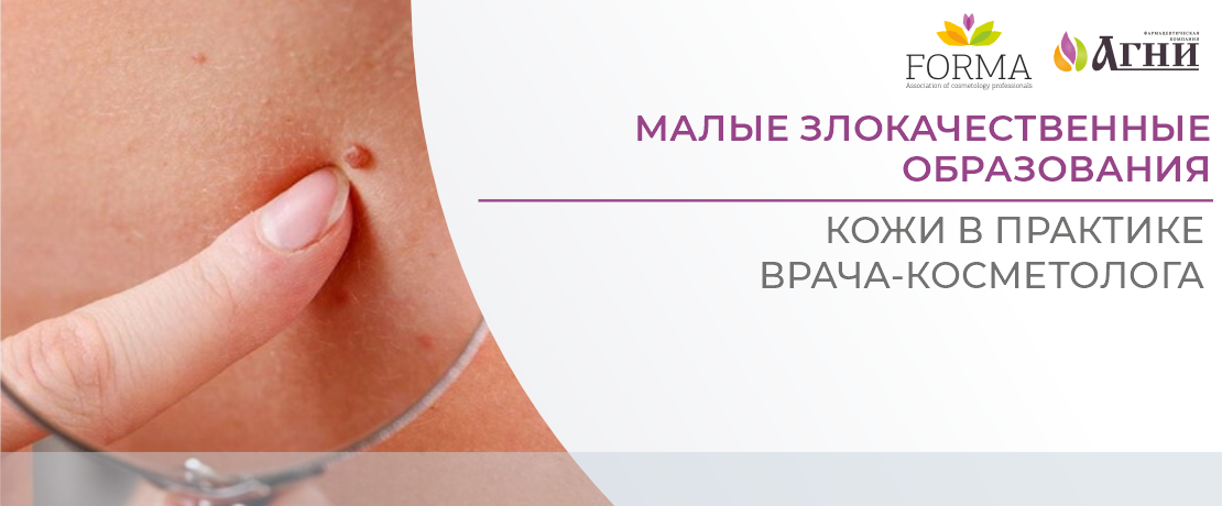 Малые злокачественные образования кожи в практике врача-косметолога