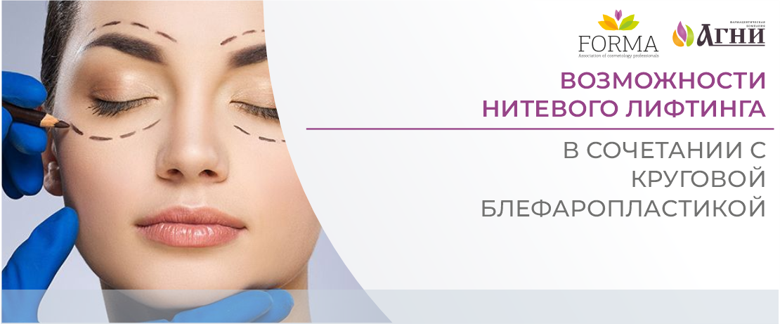 Возможности нитевого лифтинга в сочетании с круговой блефаропластикой