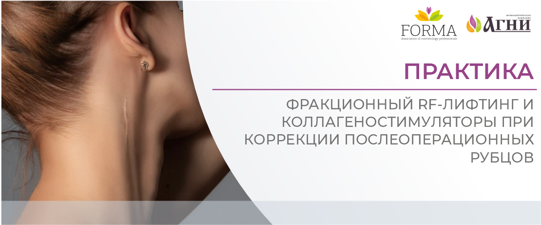 Практика: фракционный RF-лифтинг и коллагеностимуляторы при коррекции послеоперационных рубцов